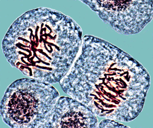 Tubercolosi: da studio ISS test per diagnosticare TBC dalle urine
